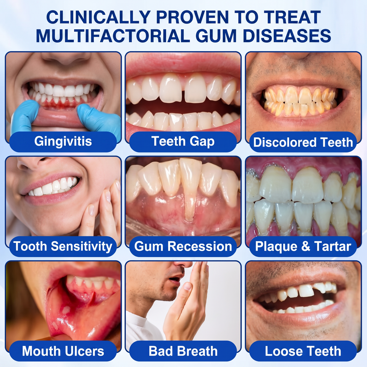 🔥Purelora® GumRevive periodontal repair gel