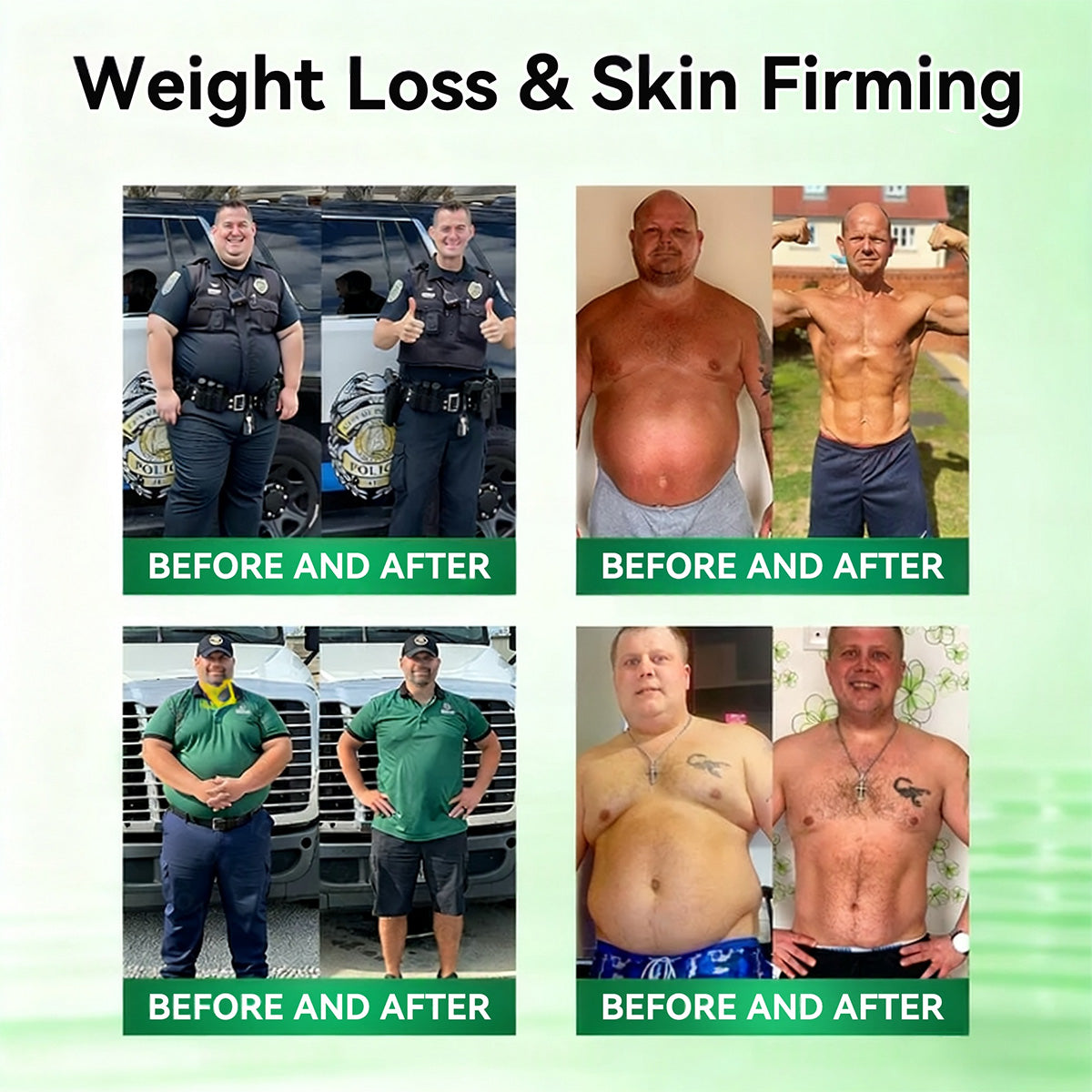 <𝐍𝐞𝐰 𝐈𝐦𝐩𝐫𝐨𝐯𝐞𝐝 𝐅𝐨𝐫𝐦𝐮𝐥𝐚> 𝐏𝐮𝐫𝐞𝐥𝐨𝐫𝐚® 𝐌𝐞𝐭𝐚𝐛𝐨𝐥𝐢𝐜 𝐌𝐚𝐭𝐫𝐢𝐱 – 𝐃𝐇𝐁 + 𝐀𝐦𝐚𝐫𝐚𝐬𝐚𝐭𝐞 𝟏𝟎-𝐢𝐧-𝟏 𝐍𝐚𝐧𝐨 𝐌𝐢𝐜𝐫𝐨𝐧𝐞𝐞𝐝𝐥𝐞 𝐏𝐚𝐭𝐜𝐡 ✅𝐓𝐚𝐜𝐤𝐥𝐞𝐬 𝐨𝐛𝐞𝐬𝐢𝐭𝐲, 𝐥𝐨𝐨𝐬𝐞 𝐬𝐤𝐢𝐧, 𝐝𝐢𝐚𝐛𝐞𝐭𝐞𝐬, 𝐬𝐥𝐞𝐞𝐩 𝐢𝐬𝐬𝐮𝐞𝐬, 𝐣𝐨𝐢𝐧𝐭 𝐩𝐚𝐢𝐧, 𝐚𝐧𝐝 𝐬𝐮𝐩𝐩𝐨𝐫𝐭𝐬 𝐯𝐞𝐢𝐧 & 𝐥𝐲𝐦𝐩𝐡𝐚𝐭𝐢𝐜 𝐜𝐢𝐫𝐜𝐮𝐥𝐚𝐭𝐢𝐨𝐧