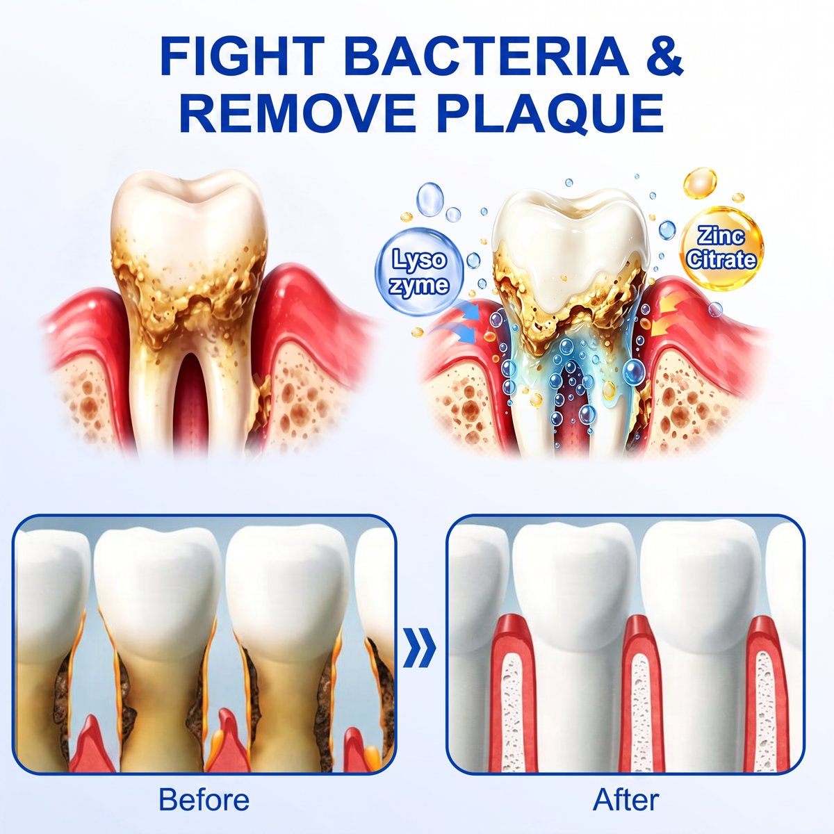 🔥Purelora® GumRevive periodontal repair gel
