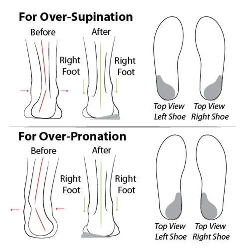 🔥 LAST DAY: 80% OFF - 👑 Women's Orthopaedic Comfort Walking Shoes, Slip-On Design, All-Day Arch Support