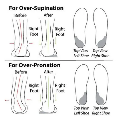 🔥 LAST DAY: 80% OFF - 👑 Women's Orthopaedic Comfort Walking Shoes, Slip-On Design, All-Day Arch Support