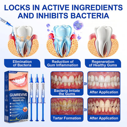 🔥Purelora® GumRevive periodontal repair gel