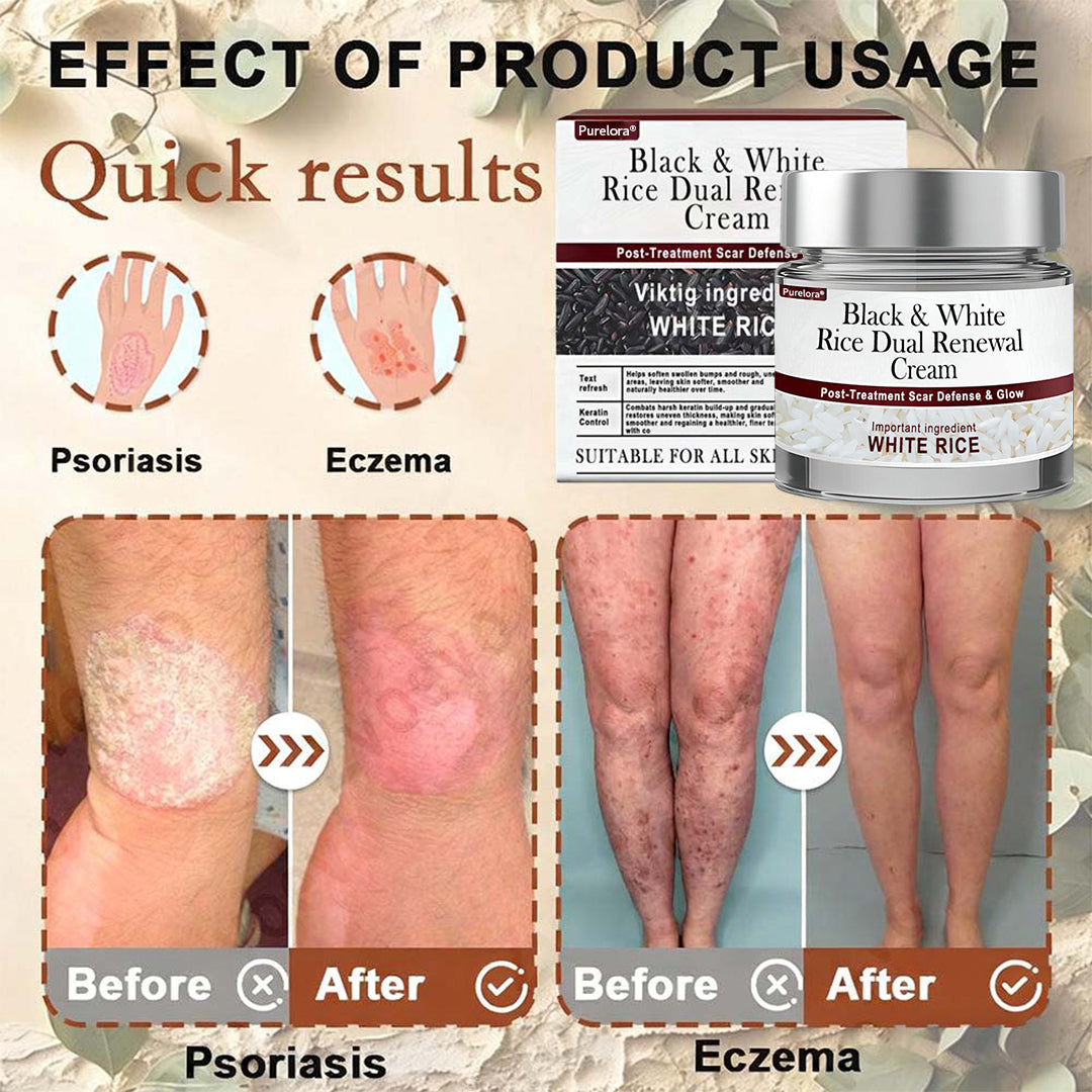 𝑶𝒏𝒍𝒊𝒏𝒆 𝑷𝒉𝒂𝒓𝒎𝒂𝒄𝒚| 𝑷𝒖𝒓𝒆𝒍𝒐𝒓𝒂® 𝑩𝒍𝒂𝒄𝒌 & 𝑾𝒉𝒊𝒕𝒆 𝑹𝒊𝒄𝒆 𝑫𝒖𝒂𝒍 𝑹𝒆𝒏𝒆𝒘𝒂𝒍 𝑪𝒓𝒆𝒂𝒎 ✨ (For removing warts, skin growths & keratin buildup, followed by intensive barrier repair to fade dark spots and prevent scarring)