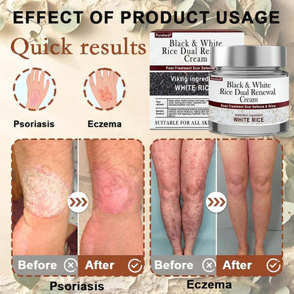 𝑶𝒏𝒍𝒊𝒏𝒆 𝑷𝒉𝒂𝒓𝒎𝒂𝒄𝒚| 𝑷𝒖𝒓𝒆𝒍𝒐𝒓𝒂® 𝑩𝒍𝒂𝒄𝒌 & 𝑾𝒉𝒊𝒕𝒆 𝑹𝒊𝒄𝒆 𝑫𝒖𝒂𝒍 𝑹𝒆𝒏𝒆𝒘𝒂𝒍 𝑪𝒓𝒆𝒂𝒎 ✨ (For removing warts, skin growths & keratin buildup, followed by intensive barrier repair to fade dark spots and prevent scarring)