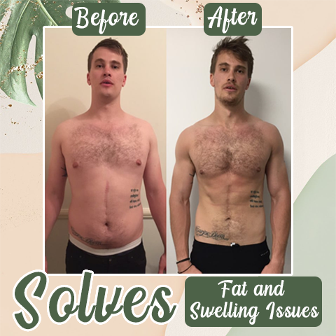 𝐏𝐮𝐫𝐞𝐥𝐨𝐫𝐚® Perfect Detox Slimming Patch（Limited Time Discount 🔥 Last Day）