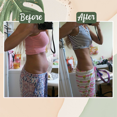 𝐏𝐮𝐫𝐞𝐥𝐨𝐫𝐚® Perfect Detox Slimming Patch（Limited Time Discount 🔥 Last Day）